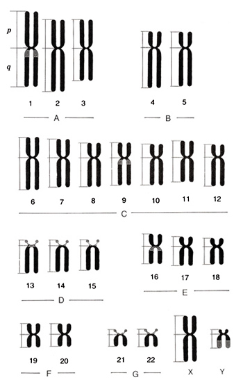 What Is A Karyotype Chart