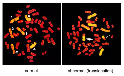 Chromosome Painting Or Fluorescence In Situ Hybridization Fish Radiation Effects Research Foundation Rerf